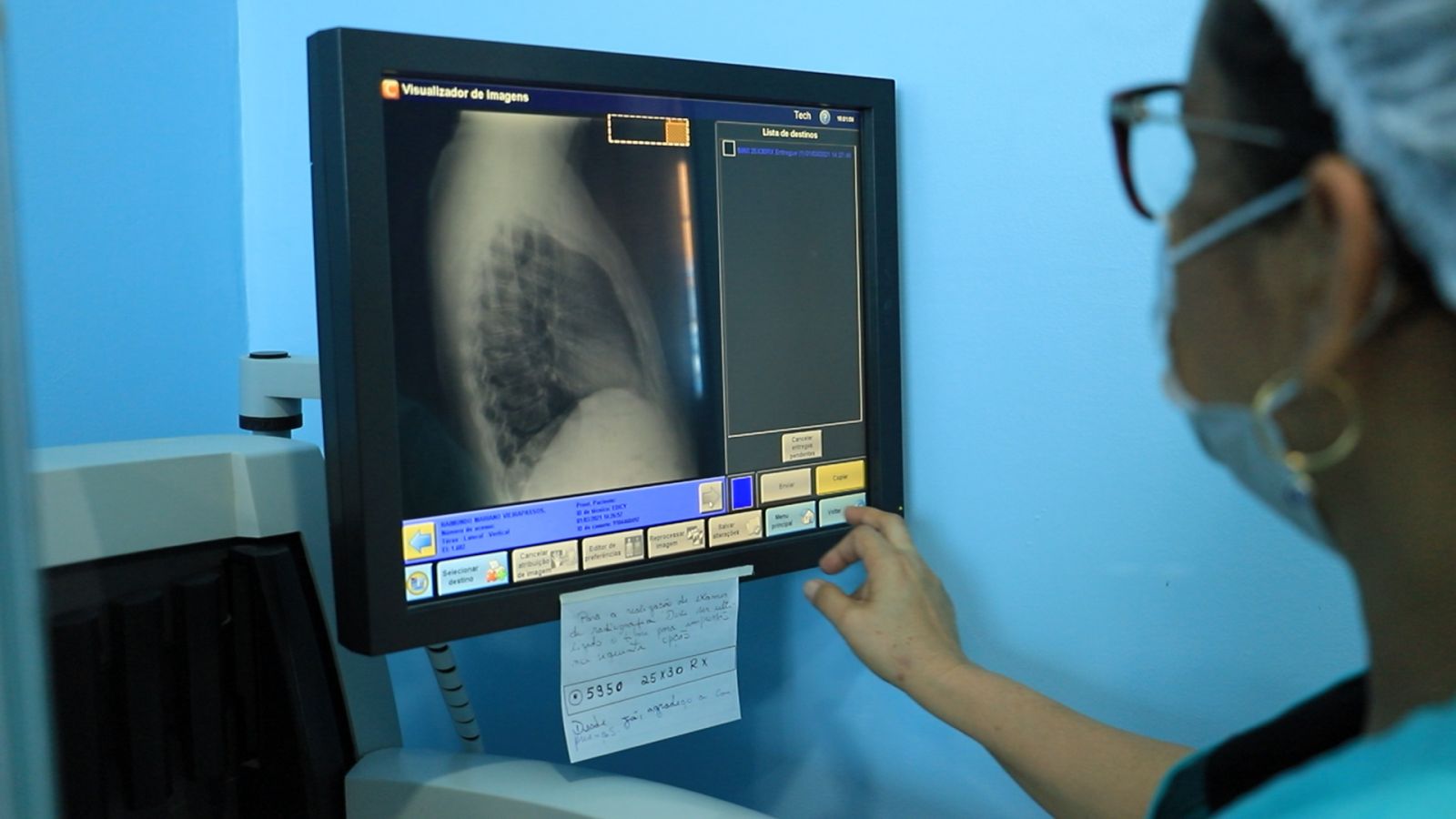 O diagnóstico é feito por exame de escarro ou raio-x de tórax